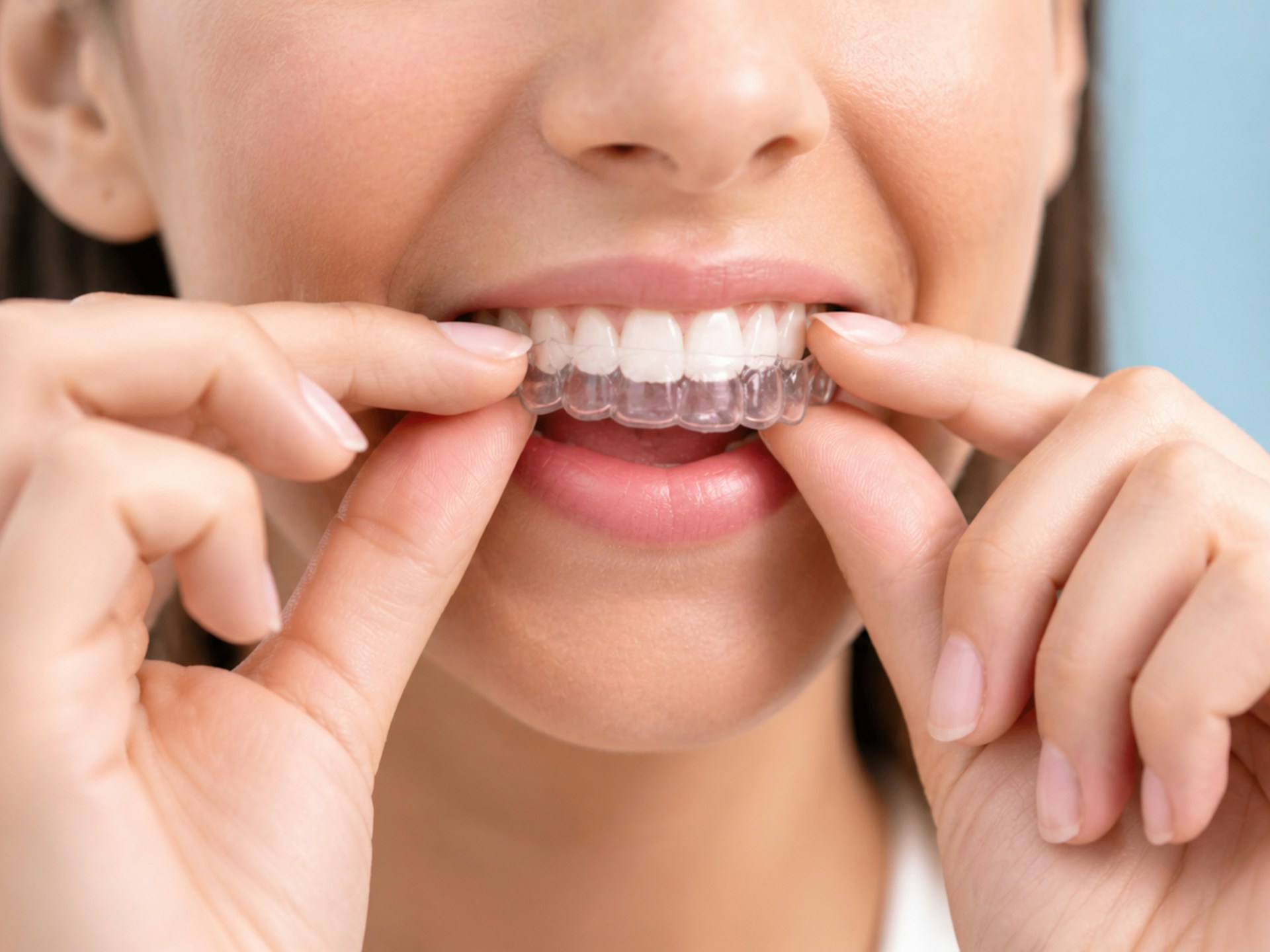 A woman adjusting clear dental aligners